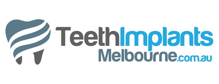 Teeth Implants Melbourne